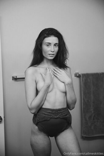 Callmeskittles