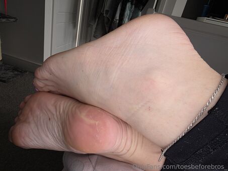 toesbeforebros_